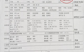 陇南找人代替抽血苏州工业园区入职体检